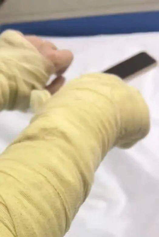 湖南一女主播被偽裝的包裹炸傷<strong></p>
<p>宏鑫機(jī)械設(shè)備有限公司
</strong>，永州公安：正在核實(shí)具體情況:宏鑫機(jī)械設(shè)備有限公司
