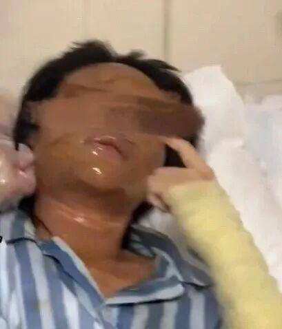 湖南一女主播被偽裝的包裹炸傷<strong></p>
<p>宏鑫機(jī)械設(shè)備有限公司
</strong>，永州公安：正在核實(shí)具體情況:宏鑫機(jī)械設(shè)備有限公司
