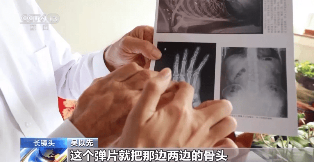 “老先生<strong></p>
<p>宏鑫機(jī)械設(shè)備有限公司
</strong>，您把項(xiàng)鏈取下來再做CT”:宏鑫機(jī)械設(shè)備有限公司
